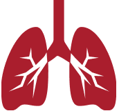 IMFINZI for Stage-3 NSCLC